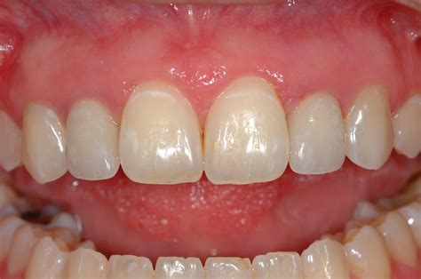 (702) 750-9875 periodontics limited - henderson